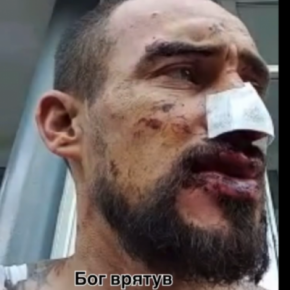 «Бог спас! Снаряд попал в блиндаж, мы чудом уцелели», – военный из Тернопольщины