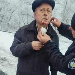В Чорткове в ДТП попал рейсовый автобус с людьми. Есть потерпевшие: подробности