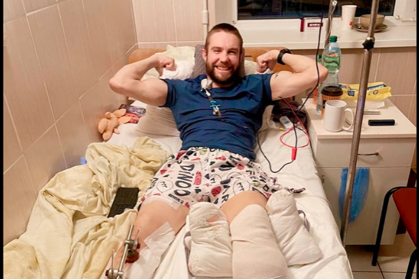 Врачам не удалось спасти ногу раненому защитнику из Тернополя