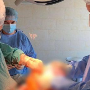 В Тернополе женщине удалили опухоль весом около 10 килограммов