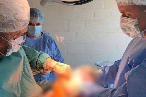 В Тернополе женщине удалили опухоль весом около 10 килограммов